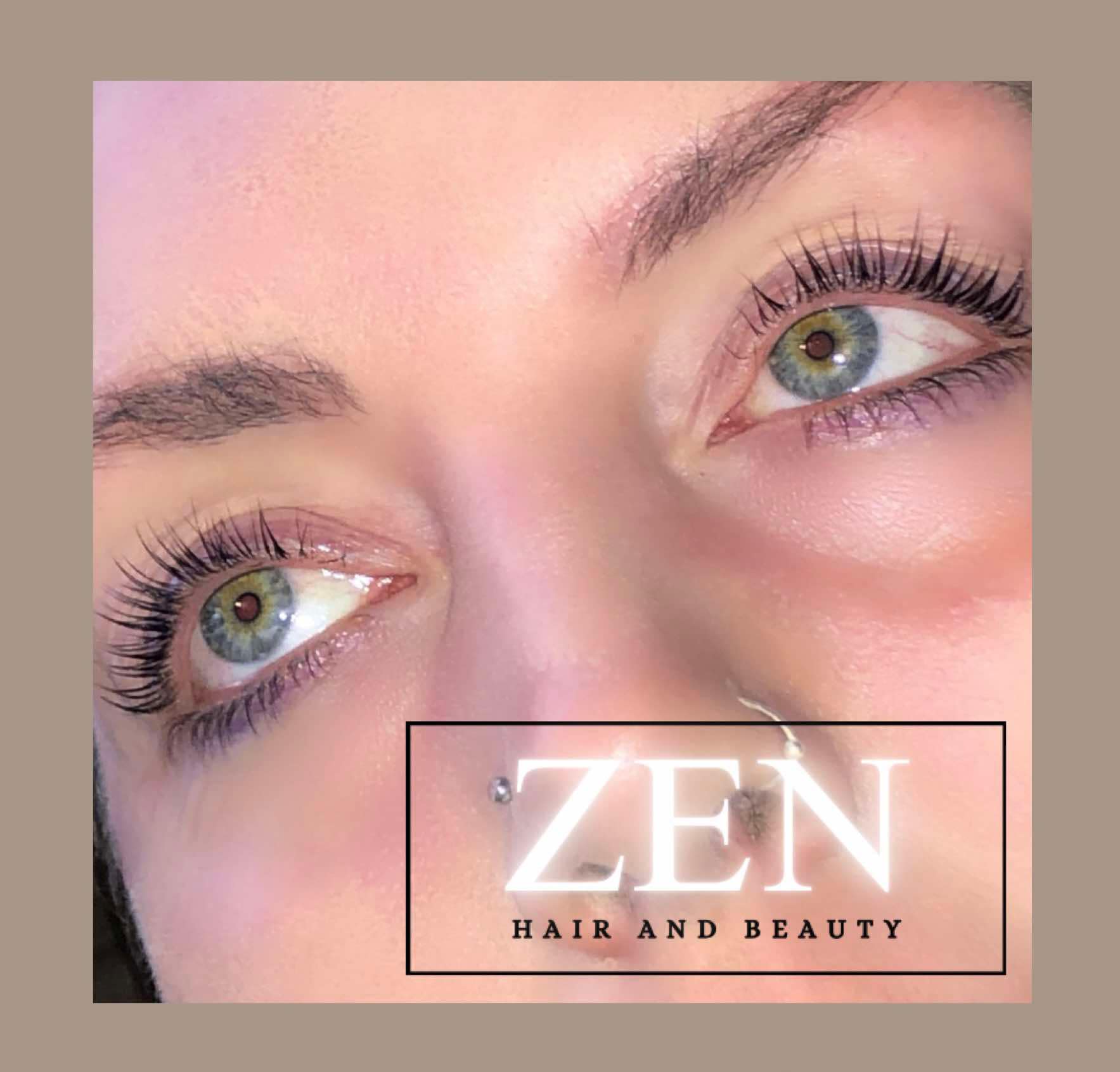 Elise Treatment photo example