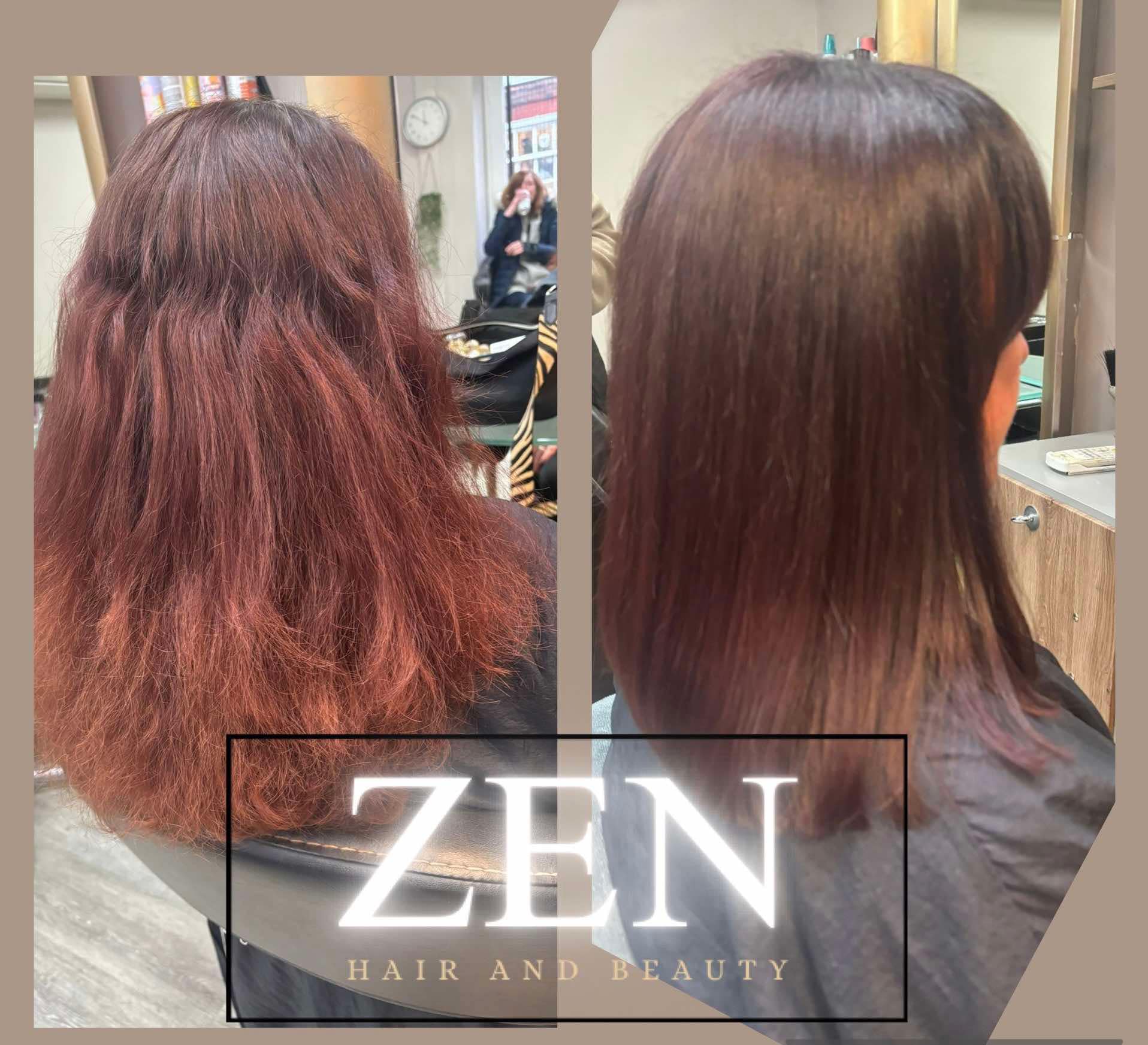 Elise Treatment photo example