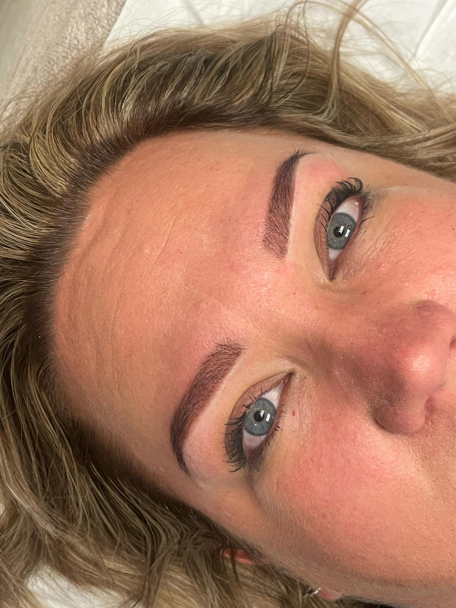 Elise Treatment photo example